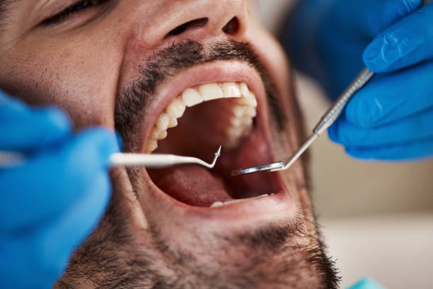 Best Tooth Infection Emergency Dentist  in Belvidere, NJ
