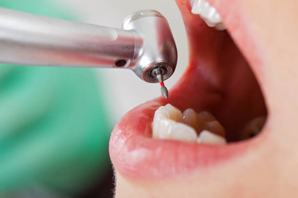 Best Broken Tooth Emergency  in Belvidere, NJ